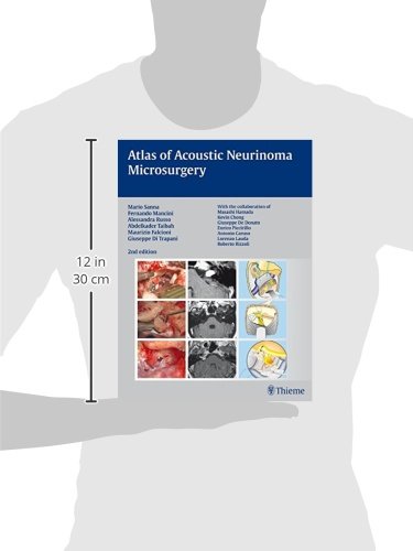 Atlas of Acoustic Neurinoma Microsurgery: . Zus.-Arb.: Mario Sanna Essam Saleh, Benedict Panizza, Al