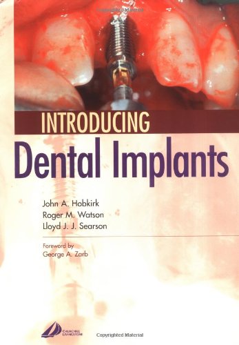 Introducing Dental Implants