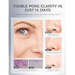 Clay Mask for Face Sensitive Skin: Triple Mud Formula, Deep Pore Cleansing, Hydrating, Oil Balancing, Smoothing, Pore Refining – 3.88 Oz - Image 5