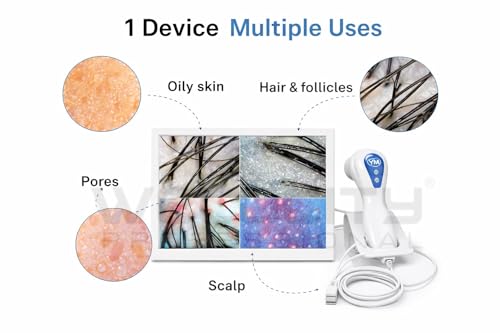 Image of Hair & Skin Analyzer Dermascope - 11.3 Inch & HD Display (50X / 200X)
