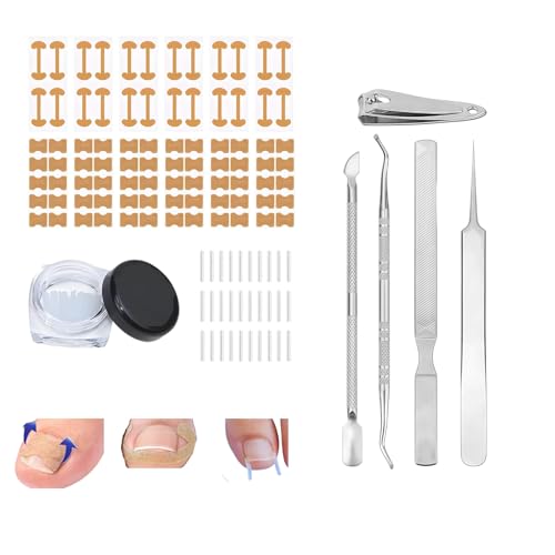 SunOutDeeal Ingrown Toenail Corrector Set with Curved Toenail Correction Patch, Upgraded Nail Removal Kit, Pedicure Tools for Home Treatment