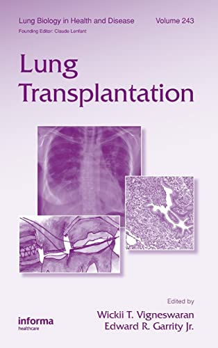 Lung Transplantation (Lung Biology in Health and Disease)