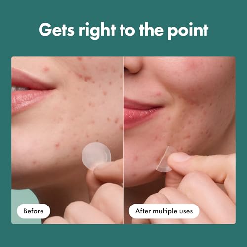 Mighty Patch HERO COSMETICS Micropoint Hydrocolloid Pimple Patches — view 6