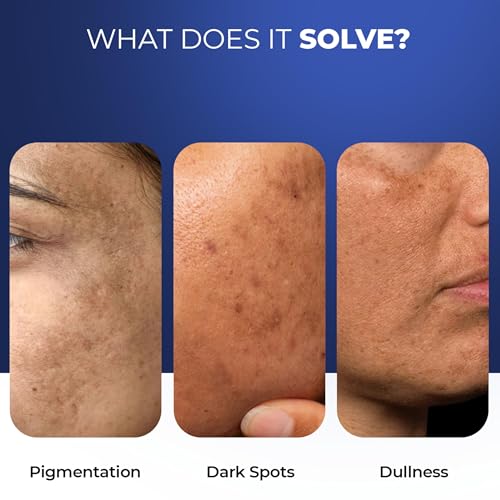 Image of Aqueria Hydrating & Brightening 3% Niacinamide French Face Serum for Glowing Skin with Alpha Arbutin | Oil Free & Non Comedogenic, Barrier Repair Serum | Fades Pigmentation, Dark Spots & Evens Skin Tone | Reduces Blackheads, Dryness, Dullness | Lightweight & Fast Absorbing | Normal, Dry, Sensitive Skin | 30ml