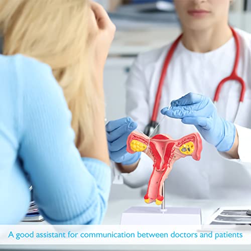 Image of ANNWAN Female Ovary Model - Life Size Human Uterus and Ovary Model Female Reproductive Organ Model for Studying and Communication