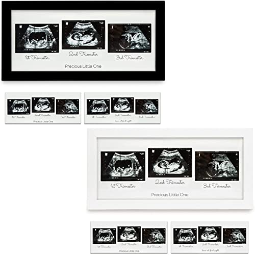 Image of KeaBabies Baby Triple Sonogram Picture Frame And Baby Triple Sonogram Frame Bundle - Baby Nursery Decor (Onyx Black) - Ultrasound Picture Frames For First Time Expecting Mom To Be (Alpine White)