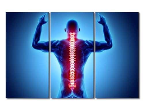3 Pieces Medical Concept Canvas Wall Art for Home Office Decoration, Modern Artwork Wrist Painful Skeleton X-Ray Posters and Prints, Wooden Framed Gallery-Wrapped, 42" Wx28 H