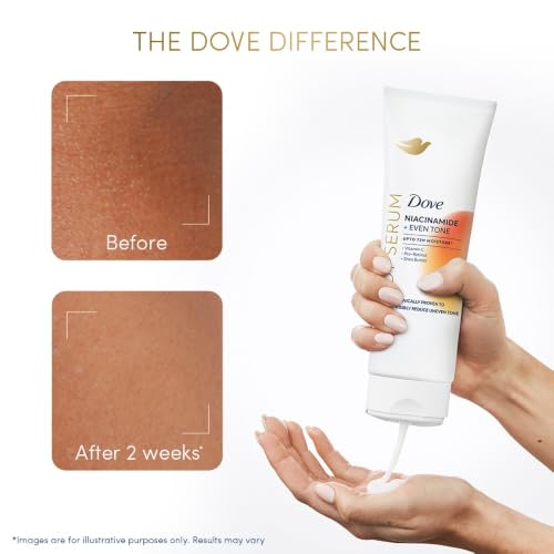 Image of Dove Niacinamide + Even Tone Body Serum | Clinically Proven Body Lotion for Pigmentation and Uneven Skin Tone | 72H Moisture | With Niacinamide & Vitamin C | 240ml