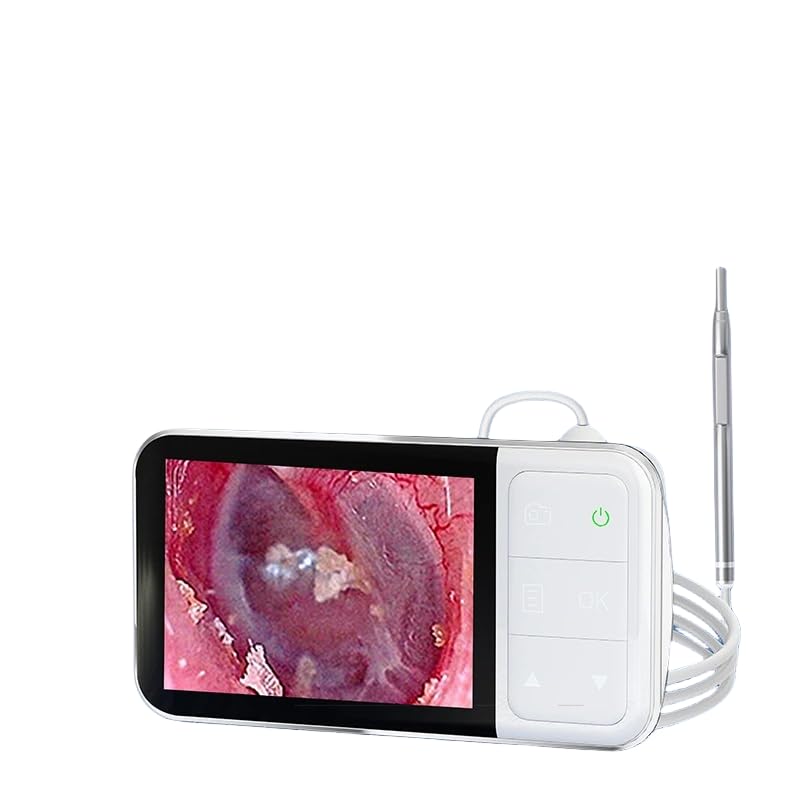QiudanTimes HD Camera Endoscope HD1080P Ear Cleaner Screen Otoscope Digital Endoscope 4.3 inch HD Screen Camera Digital Ear Monitor Earpick(4.5'-3.9mm)