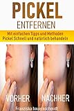 Pickel entfernen: Mit einfachen Tipps und Methoden Pickel Schnell und natürlich behandeln