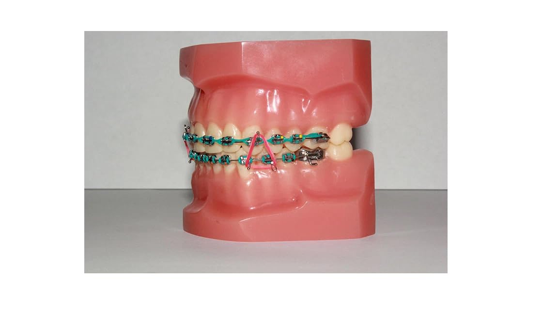 O & S Dental TopElastics City Series (Non-Latex) (Light 2.5oz (70 gm), 3/16" (5 mm))