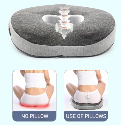 Auoketuo Anti-Dekubitus-Stuhlkissen - Orthopädisches Donut-Kissen zur wirksamen Linderung von Hämorrhoiden, Prostata, Ischias und Rückenschmerzen, ideal für Büro, Auto und Rollstuhl.