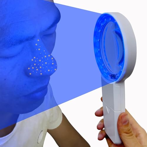 Cordless Woods Lamp Ringworm Detection Light-Skin Testing-Esthetician-Veterinaria-5x Magnifying Wood Lamp Black Light-16 LED-Battery Powered