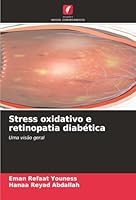 Stress oxidativo e retinopatia diabética (Portuguese Edition) 6208990041 Book Cover