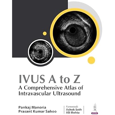IVUS A to Z