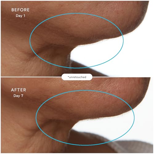 True Botanicals Natural Supersea Firming + Lifting Treatment thumb #3