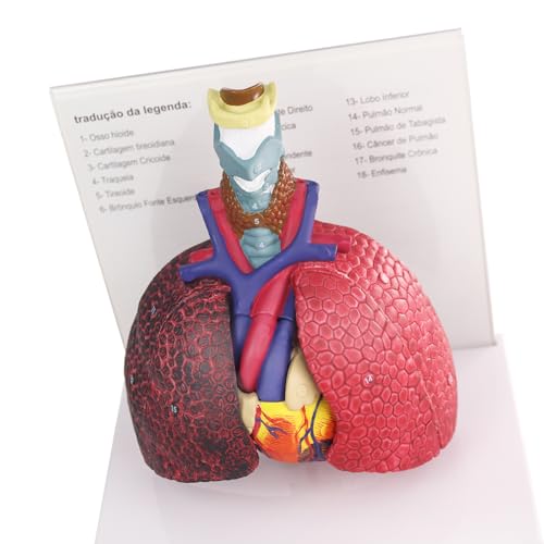 Image of HADWYN Human Respiratory System model,anatomy models human body