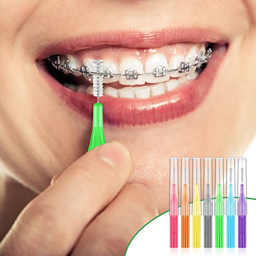 20 Stück Interdentalbürsten Zahnstocher Zahnseidekopf Dental Zahnbürste Unterschidliche Farben und Größen Zahnspangen Bürste Mundhygiene Zahnseide Zahn Reiniger Zahnreinigung Werkzeug … – Bild 6