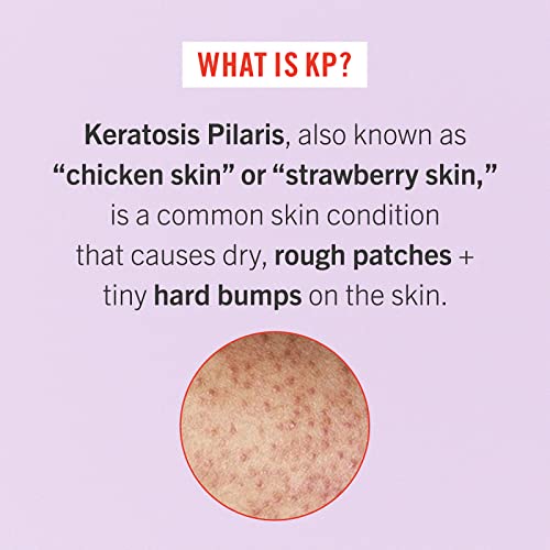 First Aid Beauty Smooth Operators Trio – 3 Exfoliating Favorites – Kp Bump Eraser Body Scrub With10% Aha, 8 Oz, Kp Smoothing Body Lotion, 6 Oz, & Ingrown Hair Pads, 28 Count #TOP1