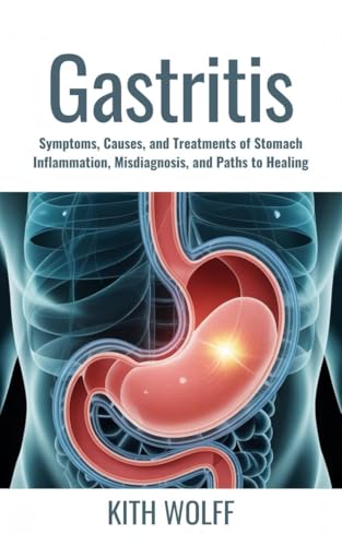 Gastritis : Symptoms, Causes, and Treatments of Stomach Inflammation, Misdiagnosis, and Paths to Healing