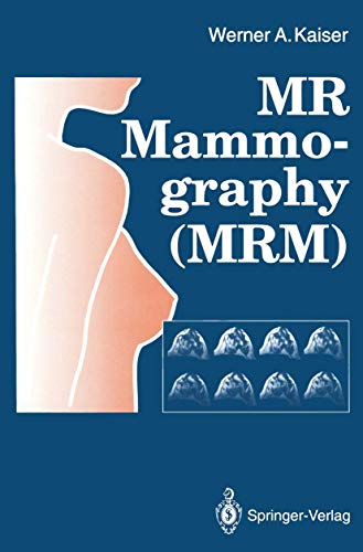 Mr Mammography Mrm view 2