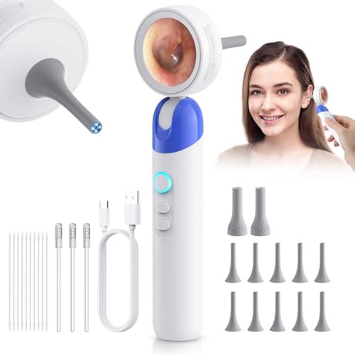 Aertnelz 1080P HD Otoscope Ear Camera for Family, Medical Grade 1.38" Screen, Telemedicine Ready, 12 Silicone Tips, Photo/Video, Type-C Charging, Home Medical(Blue)
