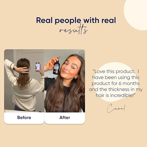 Moerie Ultimate Hair Boost Spray Designed to Strengthen Hair & Restore Scalp Health - 100% Natural Hair Serum for Hair Boost with over 100 Minerals, Vitamins & Amino acids - Fresh Scent - 5.07 Fl. Oz - Image 4