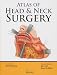 Atlas of Head and Neck Surgery