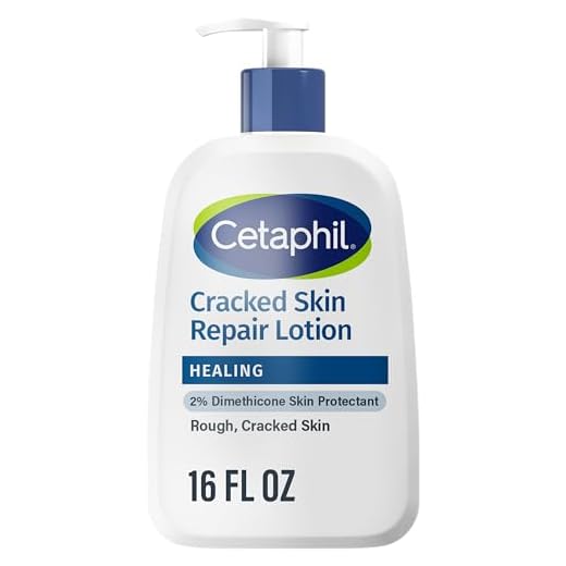 CETAPHIL Cracked Skin Repair Lotion, 16 oz, For Very Rough & Cracked, Sensitive Skin, 24 Hour Hydration, Protects & Hydrates Cracked Skin, Hypoallergenic, Fragrance Free