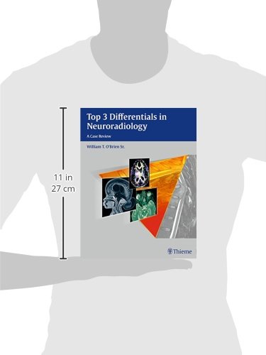 Top 3 Differentials in Neuroradiology