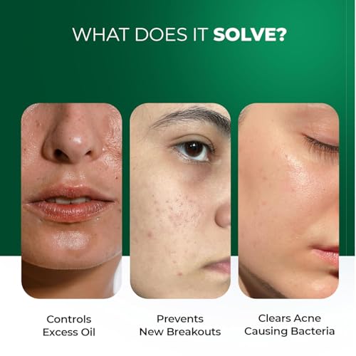 Image of Aqueria Oil Free Gel Based French Face Moisturizer & Oil Control French Face Wash for Oily, Combination & Acne Prone Skin | With Niacinamide, BHA & Multi Actives | Non-Drying, Non Comedogenic, pH Balanced | Safe for Daily Use (Pack of 4 - 50g + 50g Face Moisturizer & 20ml + 20ml Face Wash)
