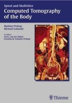 [(Spiral and Multislice Computed Tomography of the Body)] [By (author) Mathias Prokop ] published on book cover