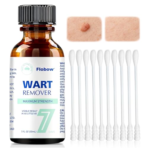 #Commissioniguadagnate<br>30 ml liquido Cura della pelle Infermieristico sollevate comune su mani e piedi per la Miglioramento della cuticola Adatto Alla Maggior Parte Delle del Corpo Per mani piedi gambe e ascelle