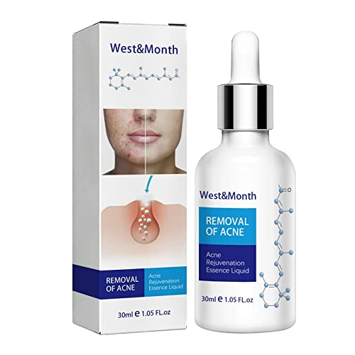 Esencia de reparación de acné, ácido salicílico 2%, Esencias antiarrugas, Eliminación de poros retráctiles, Exfoliar puntos negros, Poros encogerse Suave Hidratante 30ml