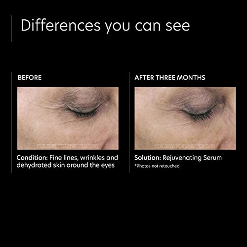 Pca Skin Rejuvenating Face Serum - Anti Aging Hydrating Treatment With Antioxidants, Peptides & Aloe Vera For Brightening Dark Spots & Preventing Fine Lines & Wrinkles (1 Fl Oz) #TOP5