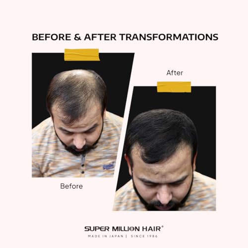 Image of Super Million Hair Hair Building Fibres - 10g Black, Black, 10 g