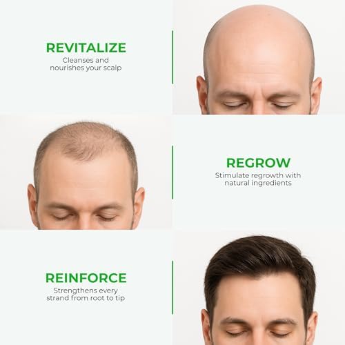 Green Wealth Neo Hair Lotion for Hair Loss Treatment | Hair Regrowth | Thinning, Bald Spots & Hair Fall | Trusted Formula with Ginseng, Saw Palmetto & Horsetail | 120ml / 4.06 fl oz