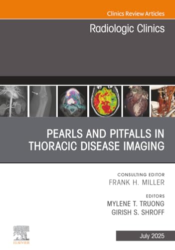  Pearls and Pitfalls in Thoracic Disease Imaging, An Issue of Radiologic Clinics of North America: 63-4
