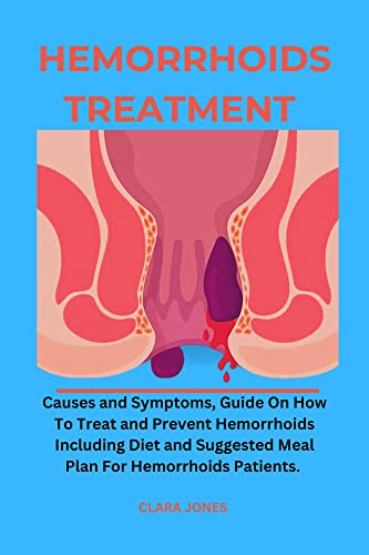 Hemorrhoids Treatment:: Causes and Symptoms, Guide on How To Treat and Prevent Hemorrhoids Including Diet and Suggested Meal Plan For Hemorrhoids Patients.