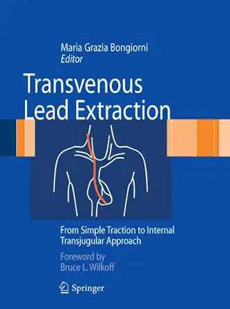 Transvenous Lead Extraction: From Simple Traction to Internal Transjugular Approach 1st ed. 2011 Edition-Wow! eBook