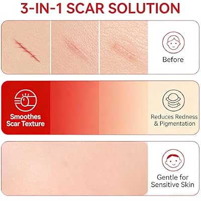 Scar Soothing Cream & Smoothing Cream for Scars - Gentle Care for Sensitive Skin, Helps Improve Appearance of Scars, Reduces Redness, Lightweight Non-Greasy Formula(2 PCS)