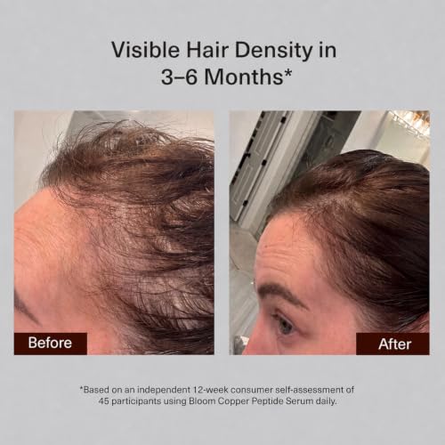 Image of Bloom Clinically Proven Copper GHK-CU Peptide Hair Serum for Hair Growth - Non-Greasy & Lightweight Advanced Multi Copper Peptides for Thinning Hair - Made in USA - 3-Pack for 3 Months Supply