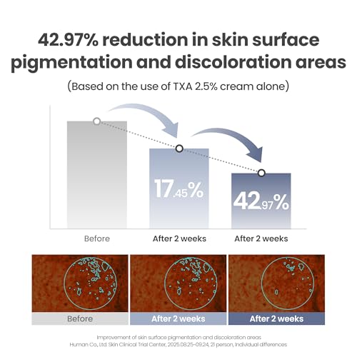 Image of AXIS-Y TXA 2.5% Intensive Brightening Cream - Tranexamic Acid Moisturizer with Niacinamide & Glutathione for Dark Spots & Uneven Skin Tone (1.69 fl. oz.)