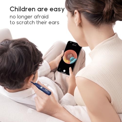 Image of Bebird Original Ear Camera Replacement Tips Apply to Earsight Plus&R1 Ultra
