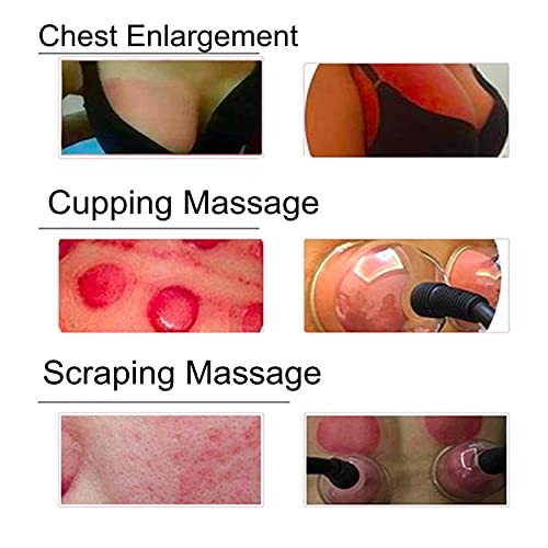 Borstmassager Vacuümmassage Borstvergroting bil opheffende cupping-apparaat voor afslanken lymfatische drainage en anti… - Afbeelding 5