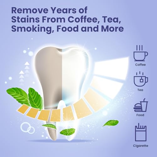 Image of BodyAccel Teeth Whitening Strips, 7 /14 Day Treatments, White Strips for Teeth Whitening, Residue-Free, Enamel Safe, Intensive Whitening, Rinse-Free (28 Count)
