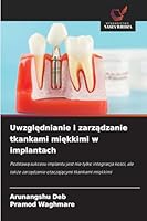 Uwzglednianie i zarzadzanie tkankami miekkimi w implantach (Polish Edition) 6208467470 Book Cover