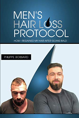 Men's hairloss protocol: How i regained my hair after going bald