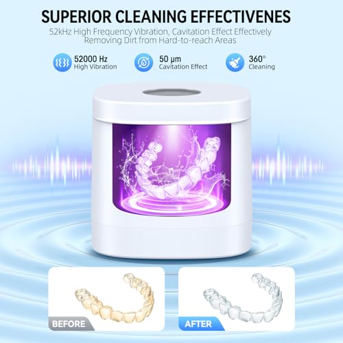 Ultrasonic Cleaner for Retainers