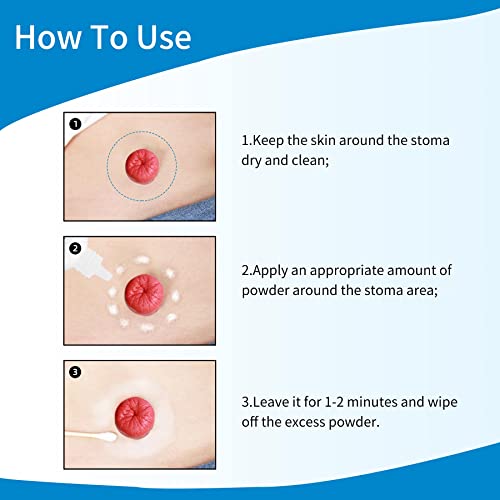 stoma powderostomy skin barrier powderostomy bag protect skin barrier adhesive amp filler
